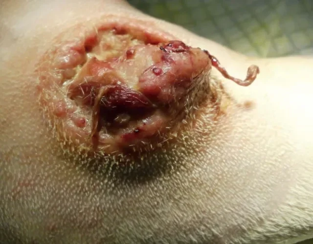 Mastocitoma em cães: num estágio avançado, é assim que o tumor se parece