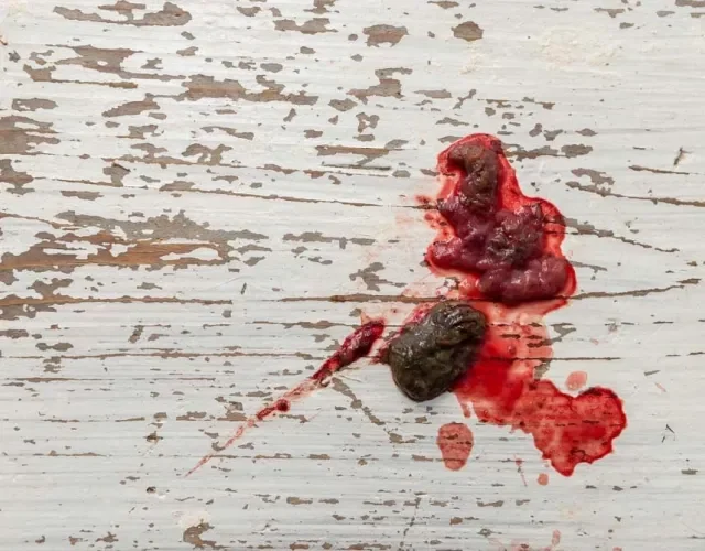 A hematoquezia em cães possui sangue vermelho com aspecto mais brilhante e fresco